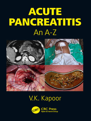 cover image of Acute Pancreatitis